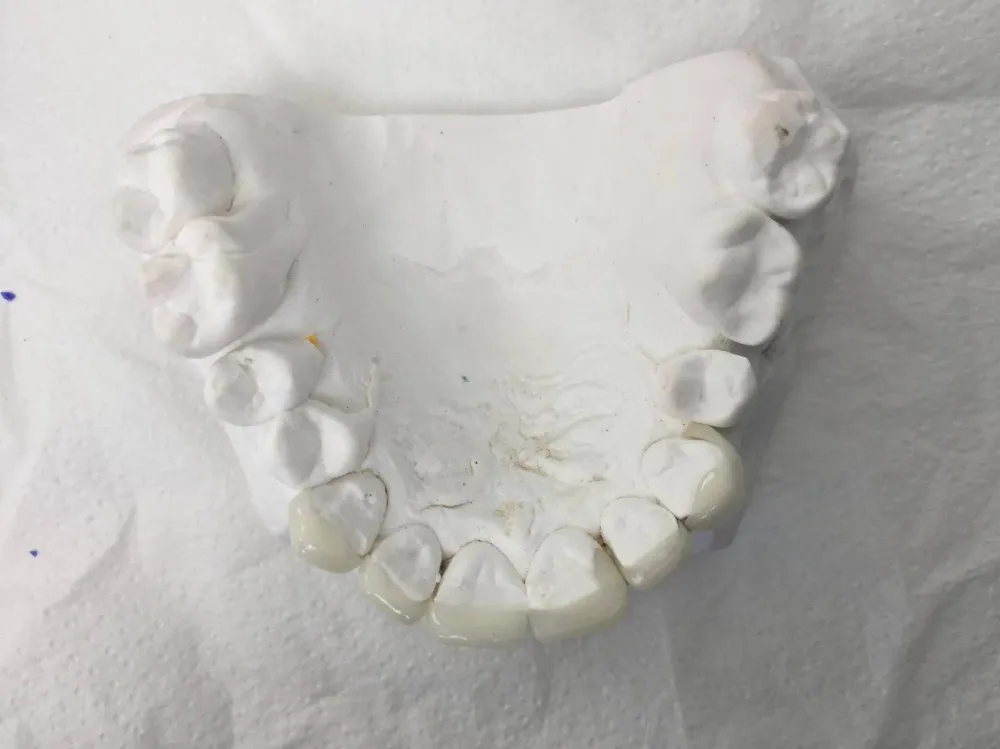 facettes dr brezel (7)